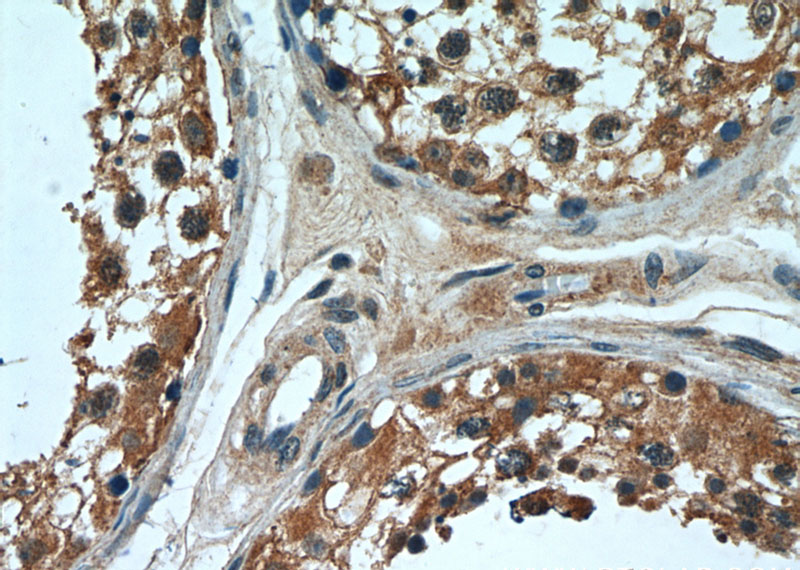 Immunohistochemical of paraffin-embedded human testis using Catalog No:113434(OSBPL9 antibody) at dilution of 1:50 (under 40x lens)