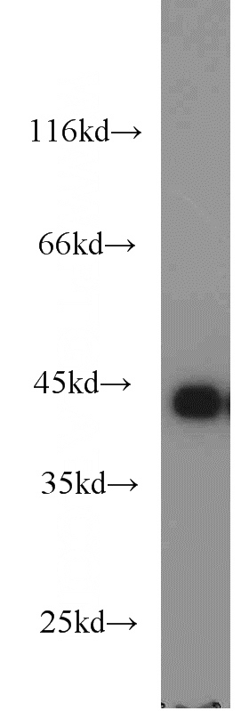 HepG2 cells were subjected to SDS PAGE followed by western blot with Catalog No:112384(MAGEB1 antibody) at dilution of 1:2000