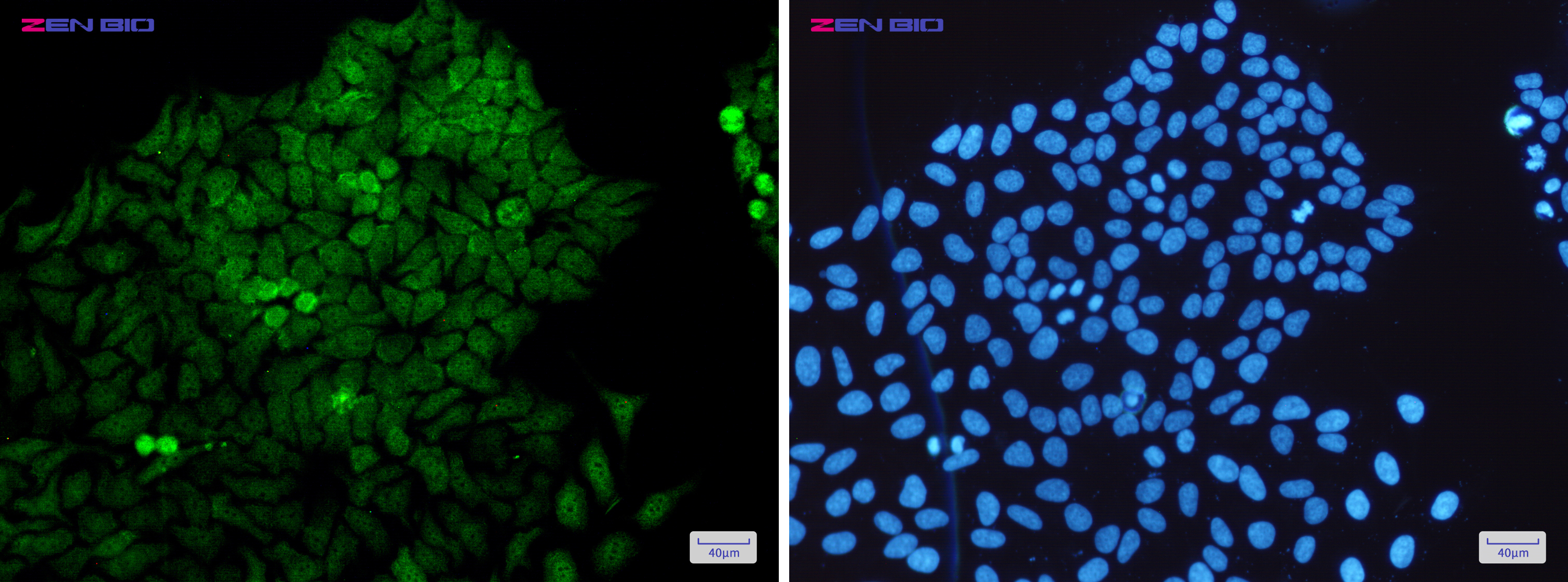 Immunocytochemistry of MEK3(green) in Hela cells using MEK3 Rabbit mAb at dilution 1/50, and DAPI(blue)