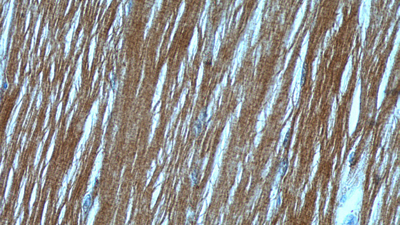 Immunohistochemistry of paraffin-embedded human skeletal muscle tissue slide using Catalog No:112934(MYH4-Specific Antibody) at dilution of 1:50 (under 40x lens)