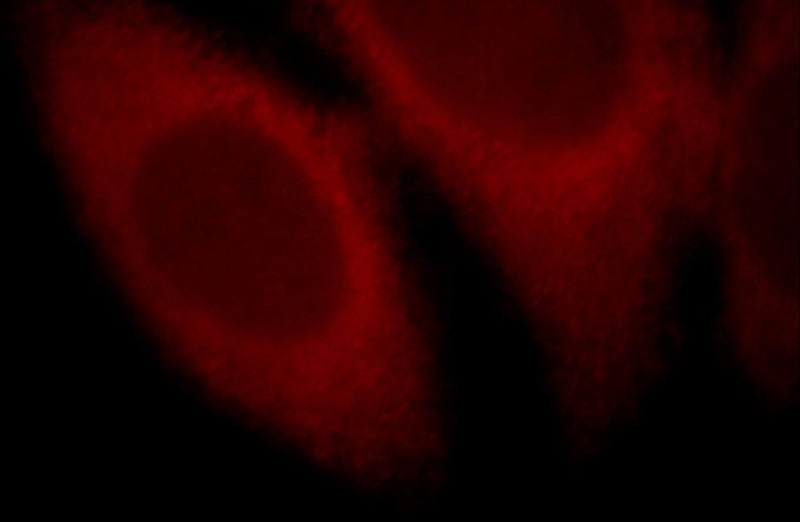 Immunofluorescent analysis of Hela cells, using GRIN2A antibody Catalog No:113245 at 1:25 dilution and Rhodamine-labeled goat anti-rabbit IgG (red).