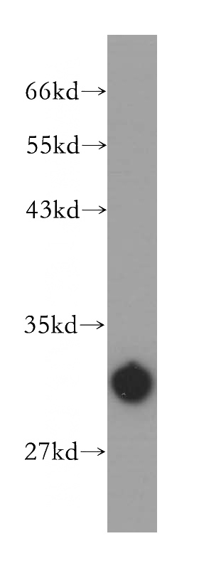 mouse testis tissue were subjected to SDS PAGE followed by western blot with Catalog No:108750(CA5B antibody) at dilution of 1:500
