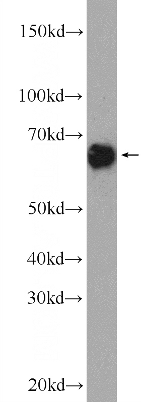 HEK-293 cells were subjected to SDS PAGE followed by western blot with Catalog No:110669(FKBP10 Antibody) at dilution of 1:600