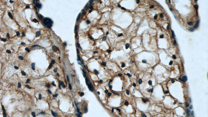 Immunohistochemical of paraffin-embedded human placenta using Catalog No:112390(MAGED1 antibody) at dilution of 1:50 (under 40x lens)