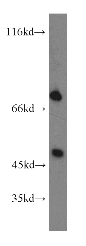 Jurkat cells were subjected to SDS PAGE followed by western blot with Catalog No:115280(PTPN11 antibody) at dilution of 1:500