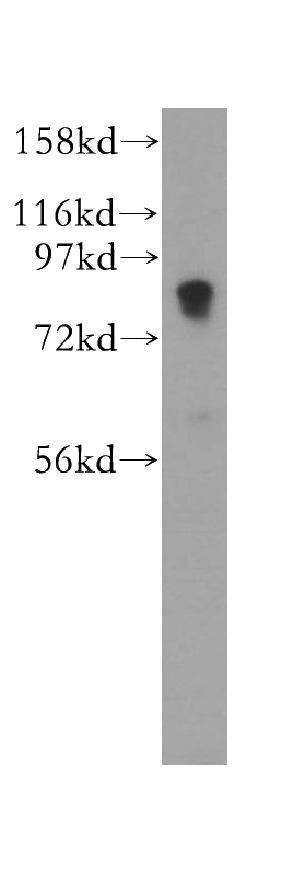 mouse lung tissue were subjected to SDS PAGE followed by western blot with Catalog No:114986(SCARF1 antibody) at dilution of 1:300