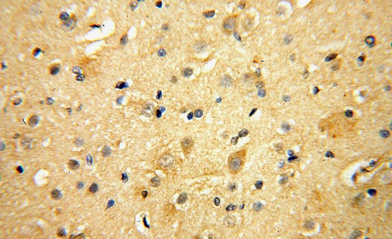 Immunohistochemical of paraffin-embedded human brain using Catalog No:114878(RPL23 antibody) at dilution of 1:50 (under 40x lens)