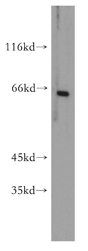 mouse testis tissue were subjected to SDS PAGE followed by western blot with Catalog No:110697(FOXG1 antibody) at dilution of 1:500