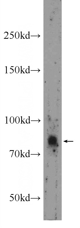 A549 cells were subjected to SDS PAGE followed by western blot with Catalog No:116609(USP35 Antibody) at dilution of 1:600