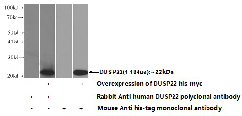 Transfected HEK-293 cells were subjected to SDS PAGE followed by western blot with Catalog No:110120(DUSP22 Antibody) at dilution of 1:1000