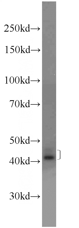 COLO 320 cells were subjected to SDS PAGE followed by western blot with Catalog No:114988(SCCPDH Antibody) at dilution of 1:1000