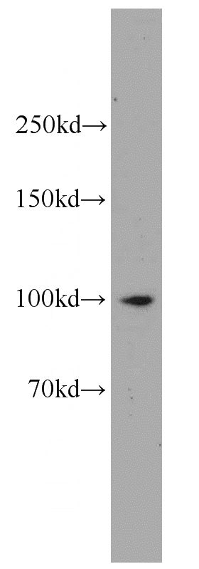 K-562 cells were subjected to SDS PAGE followed by western blot with Catalog No:111660(IL12RB1 antibody) at dilution of 1:500