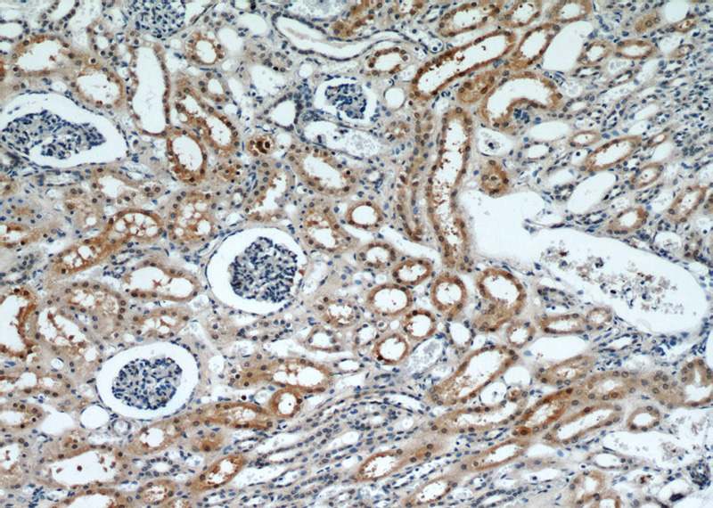 Immunohistochemical of paraffin-embedded human kidney using Catalog No:110706(FOXO4 antibody) at dilution of 1:100 (under 10x lens)