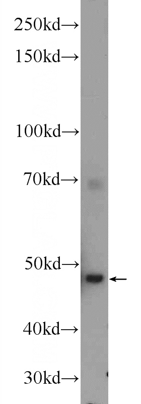 Jurkat cells were subjected to SDS PAGE followed by western blot with Catalog No:109200(CFP Antibody) at dilution of 1:300