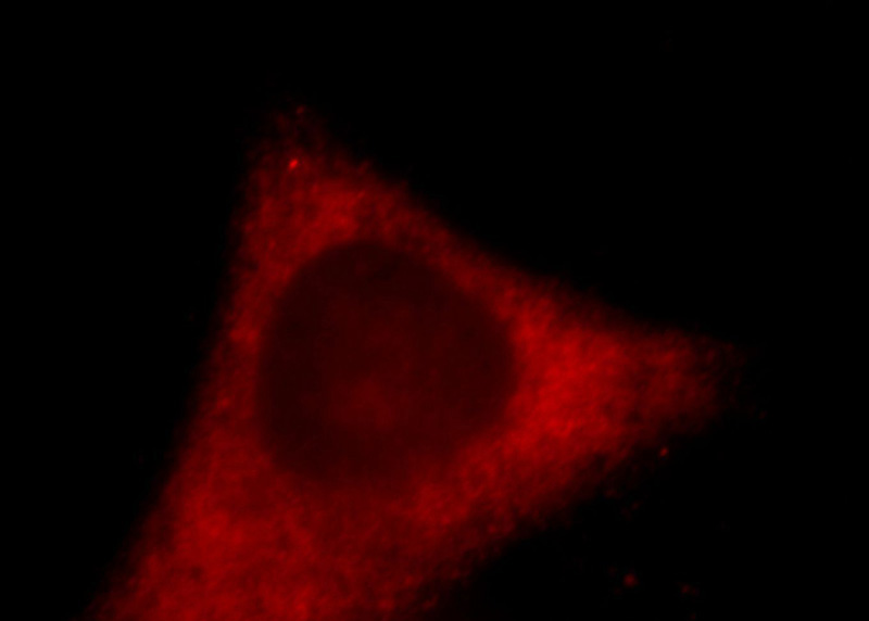 Immunofluorescent analysis of HepG2 cells, using ACSL3 antibody Catalog No:107696 at 1:25 dilution and Rhodamine-labeled goat anti-rabbit IgG (red).
