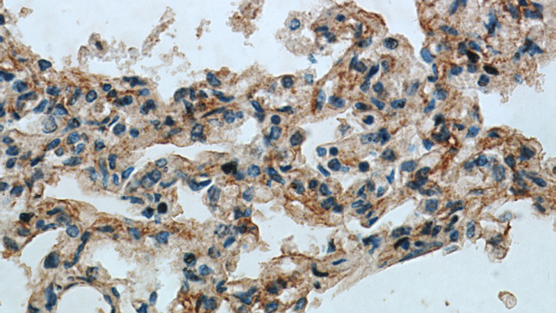 Immunohistochemical of paraffin-embedded human lung using Catalog No:117198(BMP4 antibody) at dilution of 1:50 (under 40x lens)