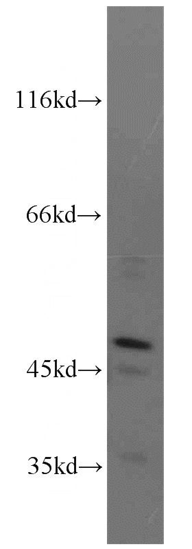 K-562 cells were subjected to SDS PAGE followed by western blot with Catalog No:113103(NEK2 antibody) at dilution of 1:500
