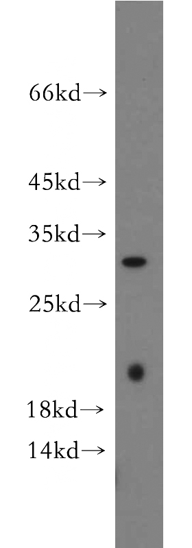 mouse pancreas tissue were subjected to SDS PAGE followed by western blot with Catalog No:111802(INMT antibody) at dilution of 1:300