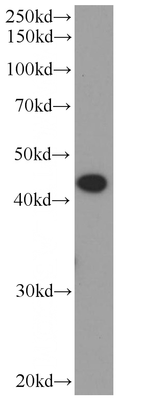 COLO 320 cells were subjected to SDS PAGE followed by western blot with Catalog No:107604(ST6GALNAC6 Antibody) at dilution of 1:500