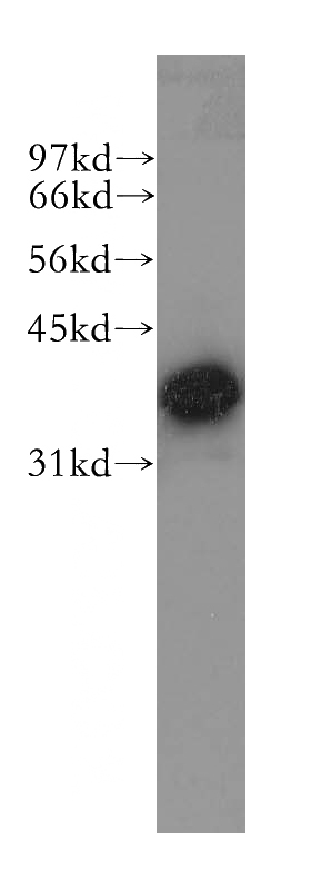 Y79 cells were subjected to SDS PAGE followed by western blot with Catalog No:112886(CRYM antibody) at dilution of 1:400