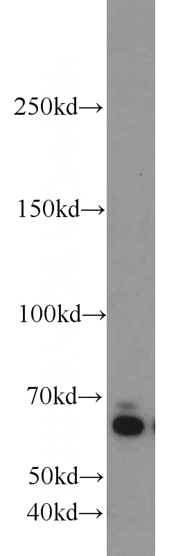 L02 cells were subjected to SDS PAGE followed by western blot with Catalog No:117051(ZGPAT antibody) at dilution of 1:1000