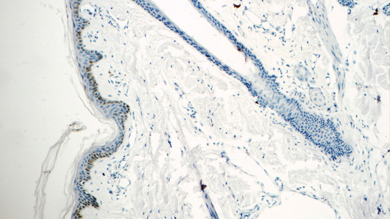 Immunohistochemistry of paraffin-embedded human skin tissue slide using Catalog No:108790(C7orf49 Antibody) at dilution of 1:25 (under 10x lens)