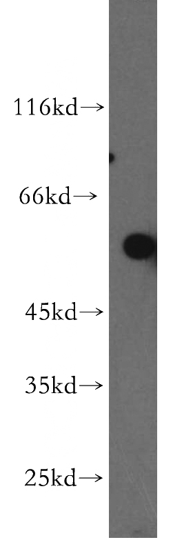 HeLa cells were subjected to SDS PAGE followed by western blot with Catalog No:115893(TBX5 antibody) at dilution of 1:300