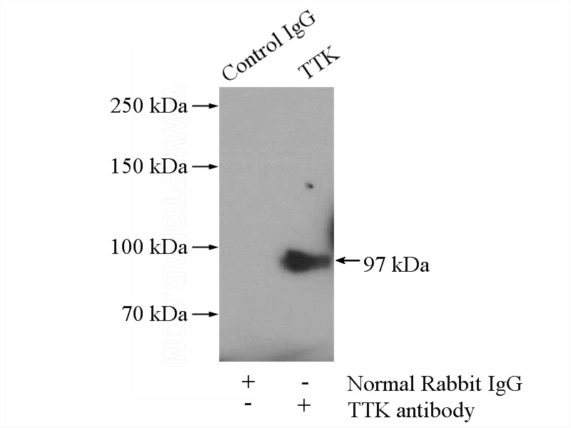 IP Result of anti-TTK (IP:Catalog No:116479, 4ug; Detection:Catalog No:116479 1:300) with MDA-MB-453s cells lysate 2800ug.