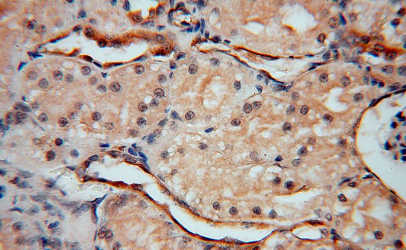 Immunohistochemical of paraffin-embedded human kidney using Catalog No:116335(Transgelin-2-specific antibody) at dilution of 1:50 (under 40x lens)