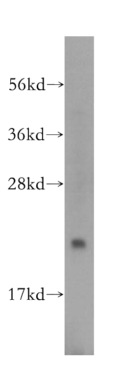 HeLa cells were subjected to SDS PAGE followed by western blot with Catalog No:114417(RAB1B antibody) at dilution of 1:500