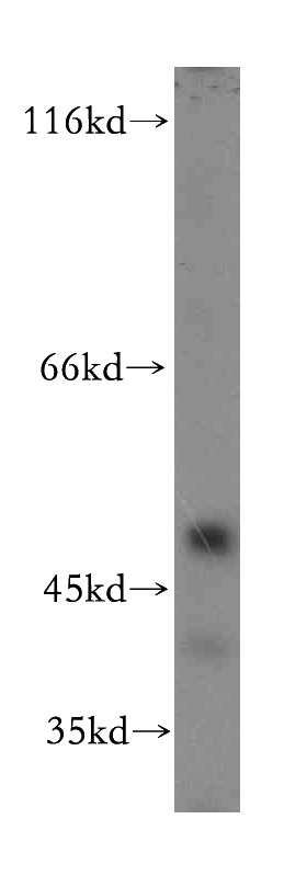 mouse brain tissue were subjected to SDS PAGE followed by western blot with Catalog No:107891(ADRA2B-Specific antibody) at dilution of 1:100
