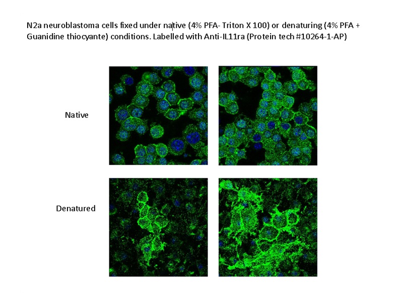 IF result of anti-IL11RA (Catalog No:111659, 1:200) with N2a cells (4%PFA fixed) by Miss Masue Marbiah, PhD student MRC Prion Unit, Department of Neurodegenerative Diseases, UCL Institute of Neurology.