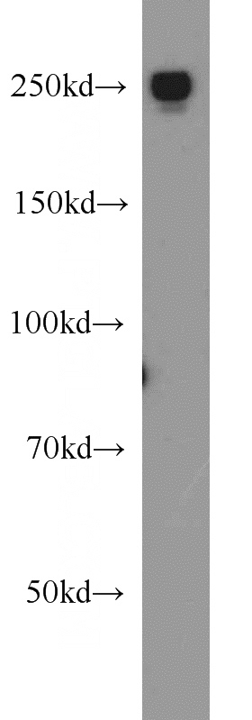 HeLa cells were subjected to SDS PAGE followed by western blot with Catalog No:110263(EIF4G1 antibody) at dilution of 1:1000