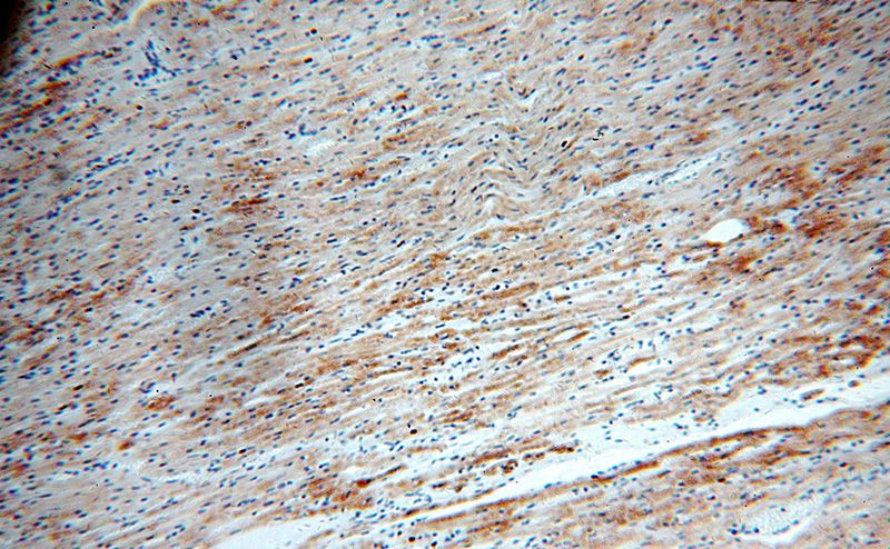 Immunohistochemical of paraffin-embedded human heart using Catalog No:115327(SLC25A20 antibody) at dilution of 1:100 (under 10x lens)