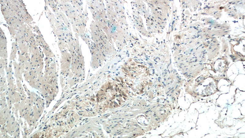 Immunohistochemistry of paraffin-embedded human colon tissue slide using Catalog No:109397(CLN6 Antibody) at dilution of 1:50 (under 10x lens)