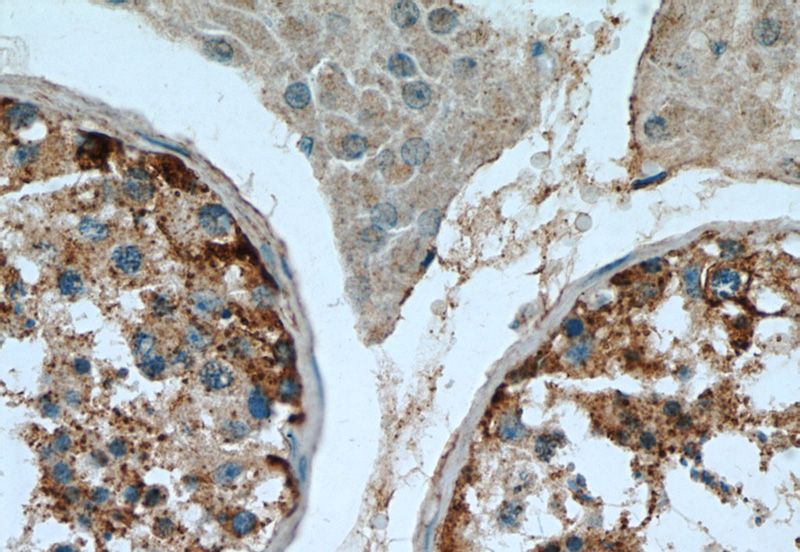 Immunohistochemical of paraffin-embedded human testis using Catalog No:115585(SRGAP1 antibody) at dilution of 1:50 (under 40x lens)