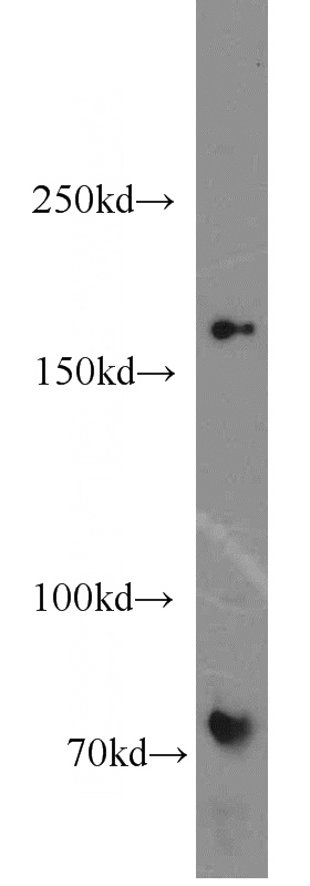 mouse heart tissue were subjected to SDS PAGE followed by western blot with Catalog No:112505(MBD5 antibody) at dilution of 1:500