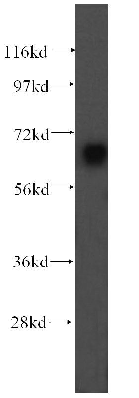 human brain tissue were subjected to SDS PAGE followed by western blot with Catalog No:116661(UBQLNL antibody) at dilution of 1:500
