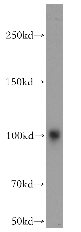 mouse testis tissue were subjected to SDS PAGE followed by western blot with Catalog No:107932(AKAP3 antibody) at dilution of 1:5000