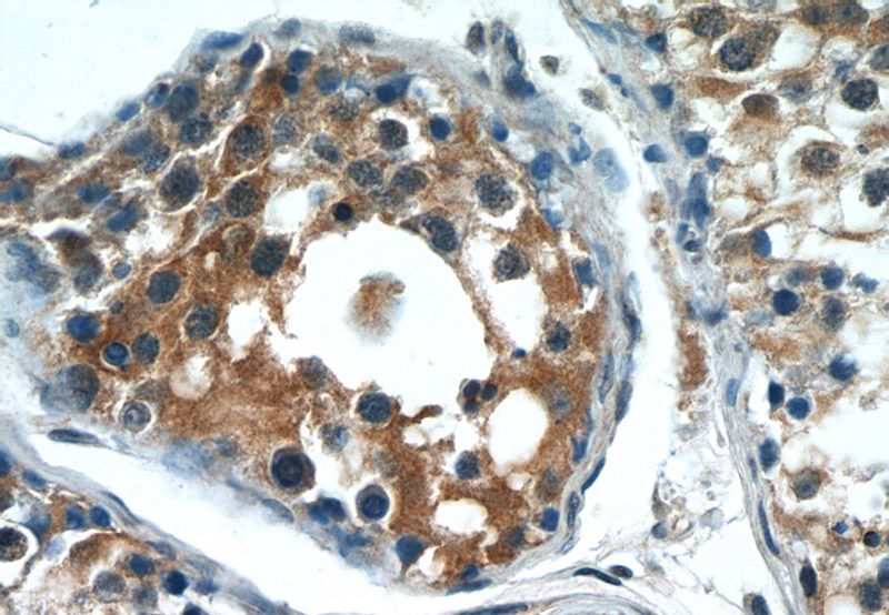 Immunohistochemistry of paraffin-embedded human testis tissue slide using Catalog No:108658(C14orf138 Antibody) at dilution of 1:50 (under 40x lens)