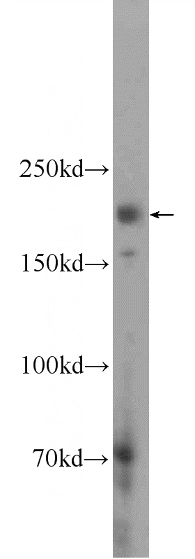 HEK-293 cells were subjected to SDS PAGE followed by western blot with Catalog No:111981(KIAA0430 Antibody) at dilution of 1:600