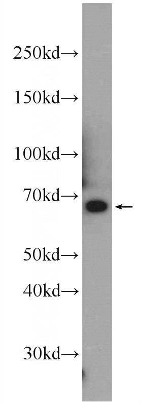 Jurkat cells were subjected to SDS PAGE followed by western blot with Catalog No:110055(DOK7 Antibody) at dilution of 1:1000