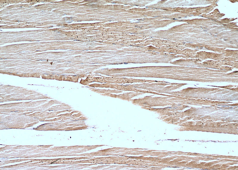 Immunohistochemistry of paraffin-embedded human skeletal muscle tissue slide using Catalog No:110149(DMD Antibody) at dilution of 1:100 (under 10x lens).