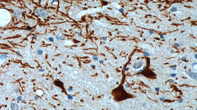 Immunohistochemistry of paraffin-embedded rat brain tissue slide using Catalog No:116034(TH Antibody) at dilution of 1:200 (under 40x lens).