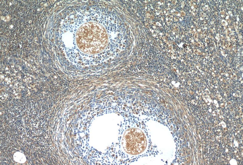 Immunohistochemistry of paraffin-embedded human ovary tissue slide using Catalog No:115177(SH2B1 Antibody) at dilution of 1:50 (under 10x lens)
