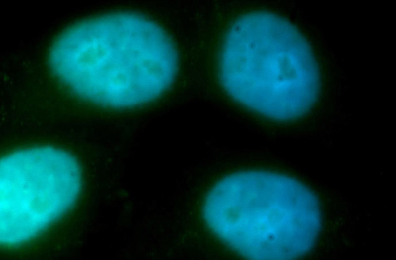 Immunofluorescent analysis of HepG2 cells, using ZWINT antibody Catalog No:117271 at 1:100 dilution and FITC-labeled donkey anti-rabbit IgG(green). Blue pseudocolor = DAPI (fluorescent DNA dye).