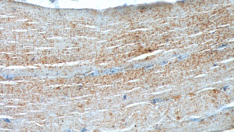 Immunohistochemistry of paraffin-embedded human skeletal muscle tissue slide using Catalog No:117121(BEST3 Antibody) at dilution of 1:200 (under 40x lens).