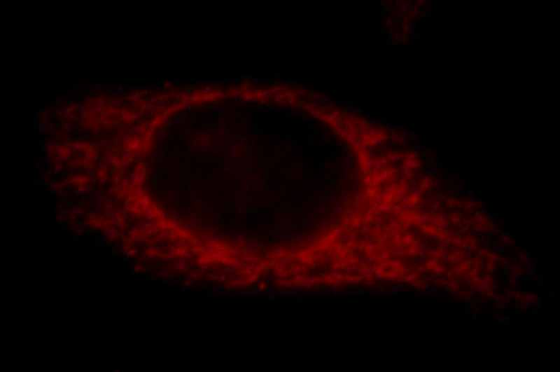 Immunofluorescent analysis of HepG2 cells, using TRIM46 antibody Catalog No:116318 at 1:25 dilution and Rhodamine-labeled goat anti-rabbit IgG (red).