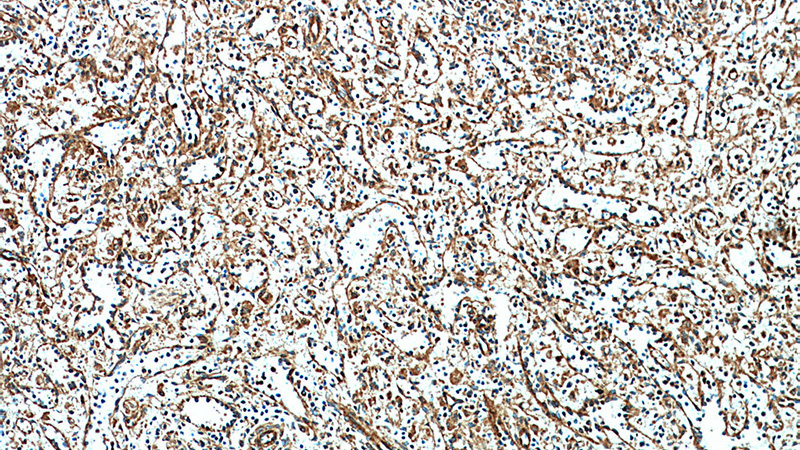 Immunohistochemical of paraffin-embedded human spleen using Catalog No:115708(STIM2 antibody) at dilution of 1:100 (under 10x lens)