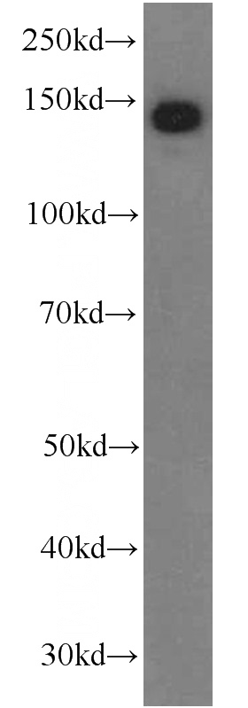 human placenta tissue were subjected to SDS PAGE followed by western blot with Catalog No:107150(CP Antibody) at dilution of 1:1000